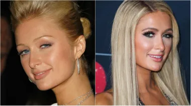Paris Hilton pravi je primjer kako obrve mogu promijeniti izgled lica i uokviriti ga - prije je nosila prirodne, tanke i jedva vidljive obrve, a danas su joj malo gušće i definitivno puno bolje izgledaju.