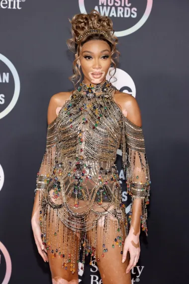 Supermodel Winnie Harlow nosila je mini haljinu s puno niti ukrašenih draguljima, a svoju svjetlosmeđu kosu podignula je u romantičnu punđu i također naglasila sa svjetlucavim detaljem. Mnogi njezin outfit smatraju jednim od najboljih na ovogodišnjoj dodjeli. 