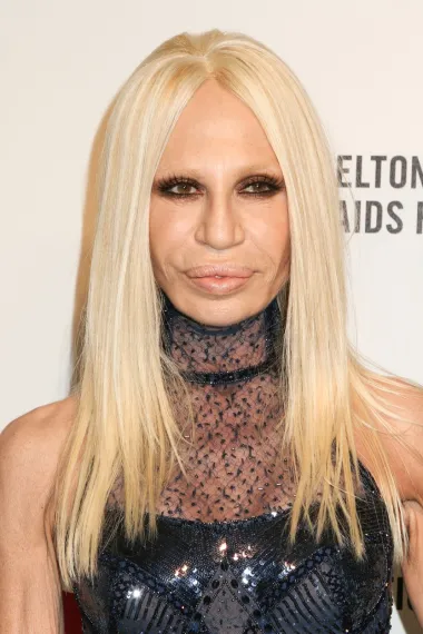 Vlasnica carstva Versace, bivši model i multimilijunašica Donatella Versace danas ima 67 godina, a već godinama se ne može pomiriti s činjenicom neizbježnog starenja. Donatella se zbog svog straha od starosti tijekom života nebrojeno puta operirala, a u konačnici je postigla neprirodan, izobličen izgled lica. Danas je Donatella znana i kao &quot;kraljica plastičnih operacija&quot;, a čak je 7 puta operirala i povećavala usne. Osim toga, njezinom izgledu nije pomogla ni navika žestokog opijanja iz mladosti, kao i opsjednutost solarijima koji su joj dodatno uništili kožu. 