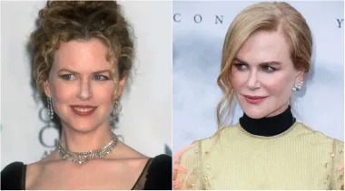 A &quot;prirodno&quot; definitivno nije riječ kojom bismo opisali slavnu glumicu Nicole Kidman. Jedna od najpoznatijih glumica današnjice nekoliko je puta otišla &quot;pod nož&quot; i itekako se promijenila tijekom godina, a iako je nekoć bila riđokosa, plava kosa postala je njezin zaštitni znak.