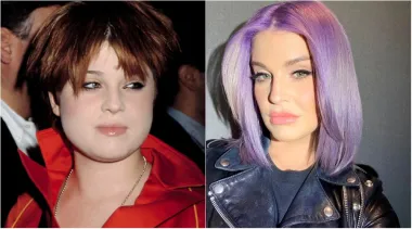 Pjevačica i kćer rock-legende Ozzyja Osbournea, Kelly Osbourne, u mladosti je kosu bojila u tamno i izgledala je puno drugačije nego danas. Iako je opovrgnula glasine da je imala plastičnu operaciju, doživjela je potpunu transformaciju - ima dulju kosu, nosi pripijenu odjeću, izgleda prirodnije, a 2018. podvrgnula se operaciji želučane premosnice, zahvaljujući čemu je izgubila čak 38,5 kilograma.