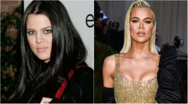 Kada bi se pojavljivala uz svoje dvije sestre Kim i Kourtney Kardashian, Khloe se često osjećala nesigurno, pa se i ona podvrgnula nekim estetskim zahvatima, zbog čega izgleda potpuno drugačije nego u prošlosti. Više se puta u životu podvrgnula plastičnim operacijama o kojima ne govori previše - priznala je samo da je operirala nos i stavila filere, ali ne i Botox.