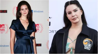 Pjevačica Lana Del Rey također izgleda drugačije nego na početku svoje karijere. Neki misle da se podvrgnula operaciji nosa i da su joj usne puno punašnije nego prije, iako ona još to nije potvrdila, a najnovije fotografije dokazuju i da se malo udebljala.