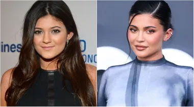 Kad je svijet prvi put upoznao Kylie Jenner, bila je tiha djevojka i najmlađa sestra Kim, Kourtney i Khloe Kardashian. Njezin je stil bio poput stila bilo koje druge tinejdžerice u Kaliforniji. Budući da smo gledali kako Jenner odrasta pred našim očima, bilo je neizbježno da će se kad-tad promijeniti. No, nitko nije mogao očekivati da će se toliko transformirati. Jenner je postala poznata na društvenim mrežama i lansirala vlastitu liniju šminke, a uz brojne filere i injekcije, uopće ne nalikuje sebi od prije nekoliko godina.