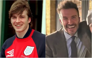 Teško je povjerovati da je bivši nogometaš David Beckham ovako izgledao na početku svoje karijere. Iako je na početku bio koncentriran na loptu, a ne na izgled, s vremenom je izravnao svoje zube i sada se može pohvaliti setom biserno bijelih zubi.