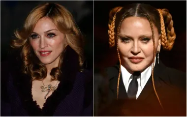 Na ovogodišnjoj dodjeli Grammyja pojavila se i Madonna koja je, u najmanju ruku, iznenadila sve prisutne izgledom.  Potpuno neprepoznatljiva, Madonna kao da više nije ista osoba. Iako je još i prije bila na metama kritika zbog  lica i koliko je drugačija no na početku karijeru, pjevačica nije otkrila jesu li u pitanju neke estetske korekcije, no definitivno je neprepoznatljiva. Stručnjaci su sigurni da se radi o plastičnoj korekciji, baš kao i dugogodišnjem korištenjem botoksa jer gotovo da nema ni jednu boru na licu. 