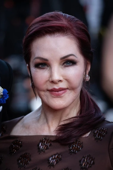 Izgledaju kao druge osobe: Slavne dame koje su estetski zahvati potpuno promijenili