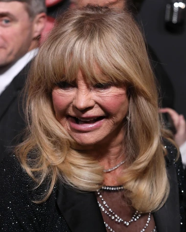 Izgledaju kao druge osobe: Slavne dame koje su estetski zahvati potpuno promijenili