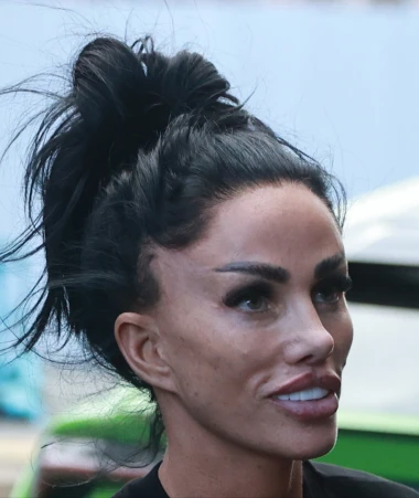 Izgledaju kao druge osobe: Slavne dame koje su estetski zahvati potpuno promijenili