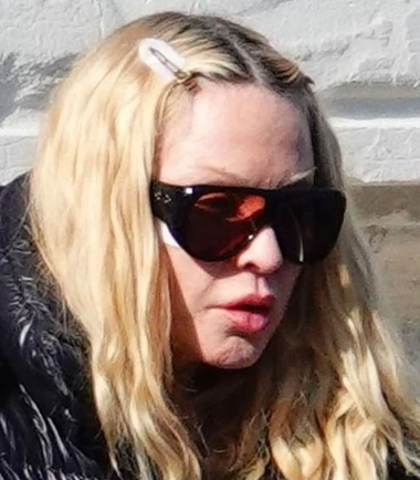 Izgledaju kao druge osobe: Slavne dame koje su estetski zahvati potpuno promijenili