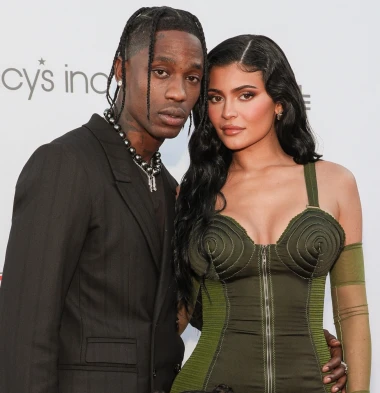 Najveću nesigurnost pretvorila je u milijunski biznis: Evo kako se Kylie Jenner mijenjala kroz godine