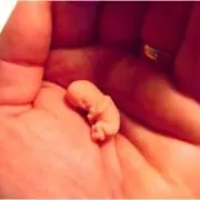 Trudnoća: Rast i razvoj vaše bebe u prvom tromjesečju