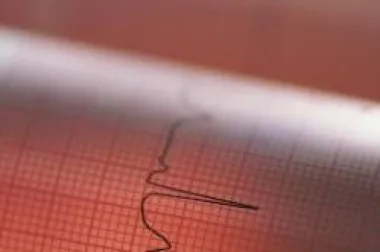 Infarkt sve više prijeti ženama