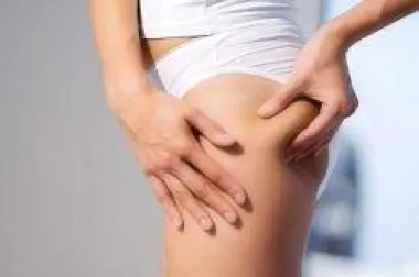 Lipolizom protiv celulita