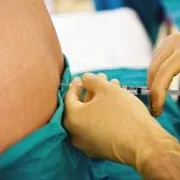 Treba li mi epiduralna anestezija? (I dio)