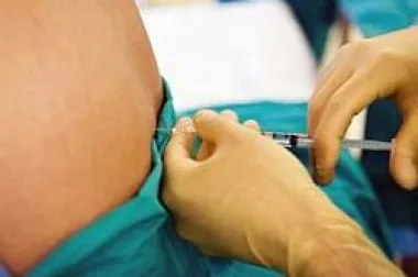 Treba li mi epiduralna anestezija? (I dio)