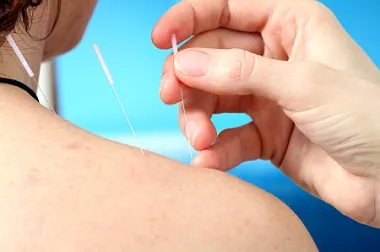 Akupunktura i homeopatija u prevenciji i liječenju gripe
