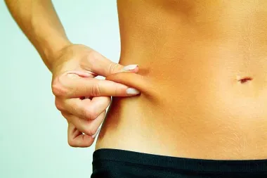 Što s viškom kože nakon gubitka kilograma?