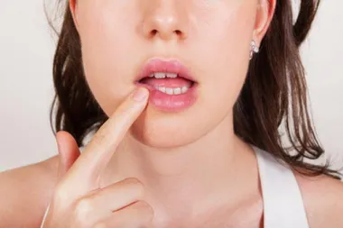 Uh, opet imam herpes na usni…