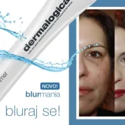 Što je blurmania i kako postići smooth efekt primerima