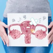 Mjesečnice znaju biti bolne, no postoji rješenje za to