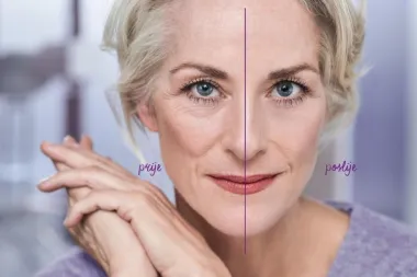 Prijavite se za recenziju Avon Anew Platinum Instant tretmana za područje oko očiju