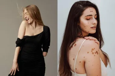 12 'nesavršenih' modela koji mijenjaju svijet mode
