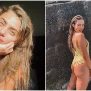 Ne skrivaju svoje tjelesne mane: Modeli čije će ti riječi pomoći da zavoliš svoje tijelo