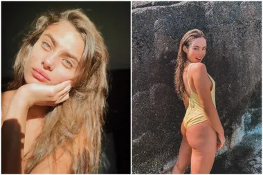 Ne skrivaju svoje tjelesne mane: Modeli čije će ti riječi pomoći da zavoliš svoje tijelo