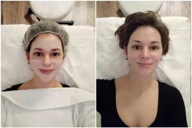 Ove zime počastila sam svoje lice s Age Smart tretmanom i nisam požalila