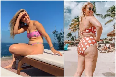 Imaš celulit ili strije? Opusti se i uživaj. Ove dame ponosno pokazuju nesavršenosti i prava su inspiracija