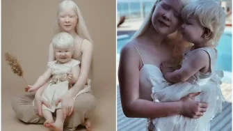 Iako je između njih 12 godina razlike, ove albino sestre raznježile su svijet svojom ljepotom