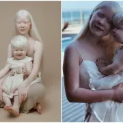 Iako je između njih 12 godina razlike, ove albino sestre raznježile su svijet svojom ljepotom