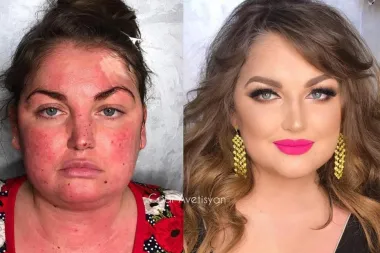 Šminka čini čuda: Ova vizažistica bolesnim ženama daruje makeover iz snova