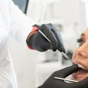 Stomatolog otkrio koji je najčešći problem sa zubima, ali i kako ga riješiti za nekoliko minuta