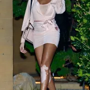 Winnie Harlow