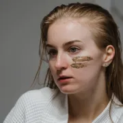 Crne točkice na licu nisu uvijek miteseri. Evo što mogu biti i kako ih umanjiti