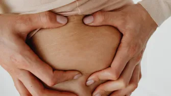Strije - neželjene šare na koži koje uz nekoliko trikova možeš umanjiti