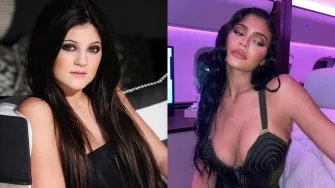 Prirodno vs plastika: Zvijezde koje izgledaju kao druge osobe nakon operacija