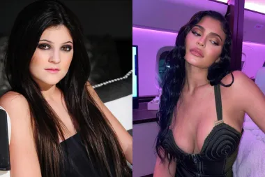 Prirodno vs plastika: Zvijezde koje izgledaju kao druge osobe nakon operacija