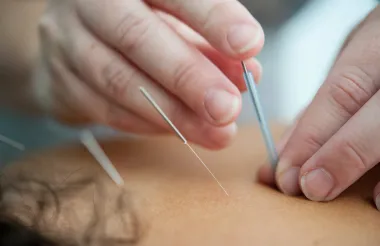 Koje bolesti se mogu liječiti akupunkturom?