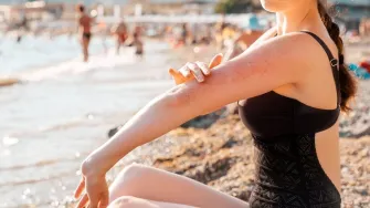 Alergija na sunce: Sve što trebaš znati o simptomima, rizicima i prevenciji