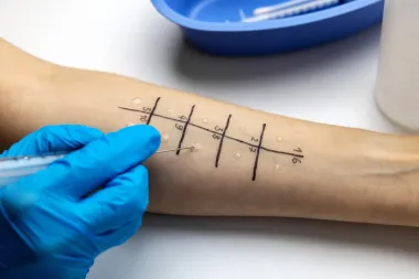11 važnih savjeta koji ti mogu olakšati sezonske alergije