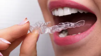 Želiš ljepše zube? Pitali smo stručnjaka na koje sve načine možeš to postići