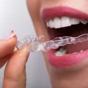 Želiš ljepše zube? Pitali smo stručnjaka na koje sve načine možeš to postići