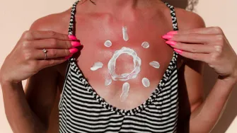 Kad te sunce 'opali' - kako pravilno tretirati opekline?
