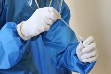 Majmunske boginje - sve što trebaš znati o ovoj virusnoj bolesti