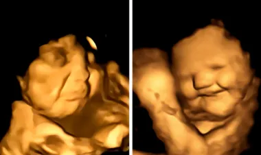 Znanstvenici otkrili: Bebe rade grimase u trbuhu kada mama jede određenu hranu