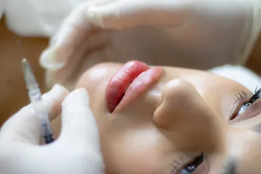 Fileri: 8 stvari koje trebaš znati o jednom od najpopularnijih estetskih tretmana