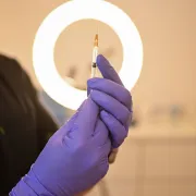 Sve više Hrvata odlazi na estetske tretmane: Saznali smo koji su najpopularniji
